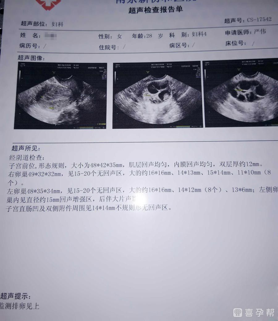 女性子宫先天性畸形能正规医院做供卵要多少钱婴儿吗